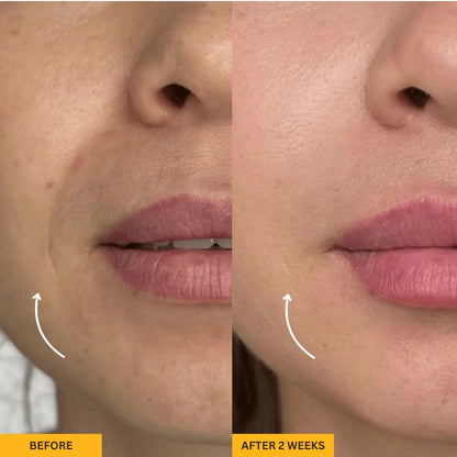 Evastes™ Sculpting Gua Sha